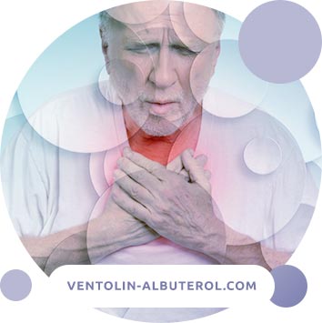 Bronchial asthma